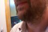 Beard