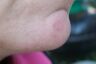 Chin