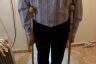 Crutches