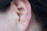 Ear