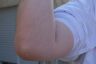 Elbow