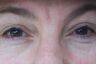 Eyes