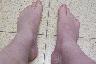 Feet