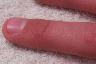 Finger