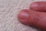 Fingernail