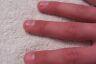 Fingers