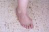 Foot