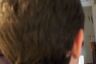Hair