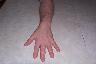 Hand