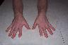 Hands