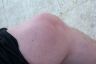 Knee
