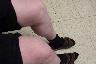 Knees