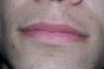 Lips