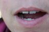 Mouth