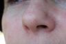 Nose