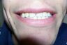Teeth