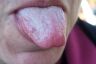 Tongue